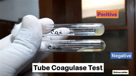 coagulase test results